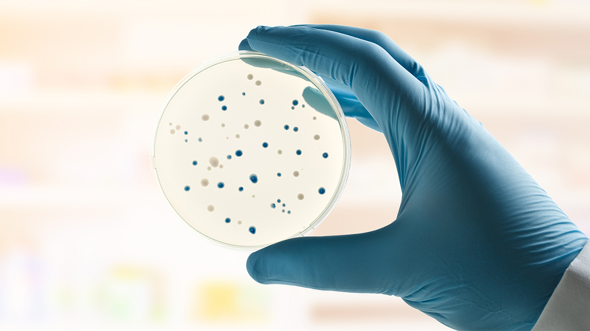 holding a petri dish